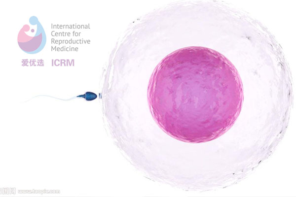 ICRM俄罗斯试管婴儿