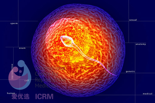 ICRM俄罗斯试管婴儿