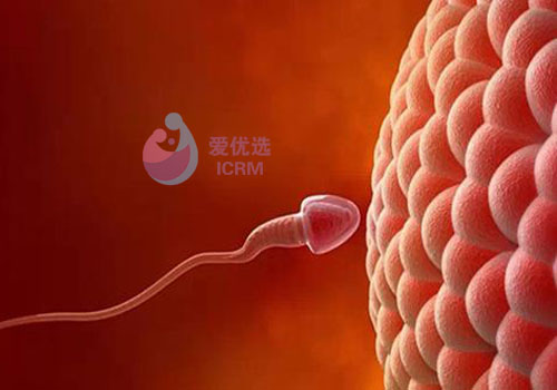ICRM俄罗斯试管婴儿