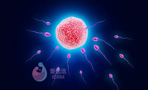 ICRM俄罗斯试管婴儿