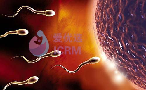 ICRM俄罗斯试管婴儿