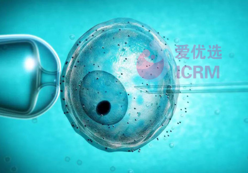 ICRM俄罗斯试管婴儿