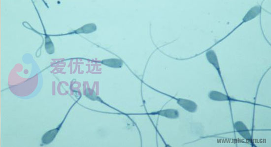 ICRM俄罗斯试管婴儿