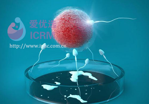 ICRM俄罗斯试管婴儿