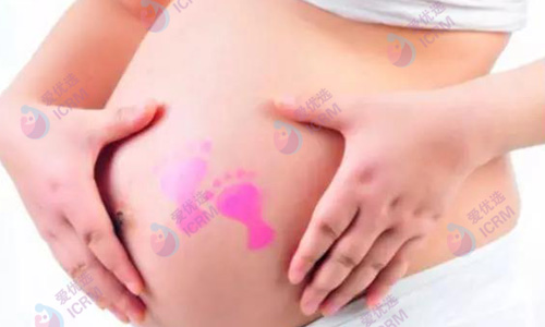ICRM俄罗斯试管婴儿