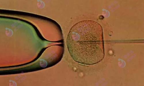 ICRM俄罗斯试管婴儿