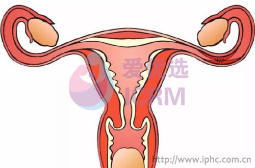 ICRM俄罗斯试管婴儿