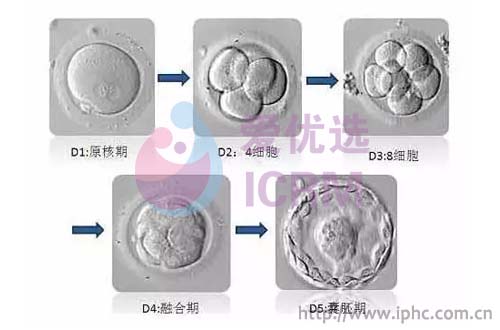 ICRM俄罗斯试管婴儿