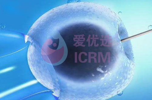 ICRM俄罗斯试管婴儿