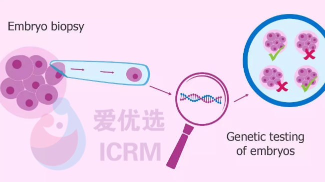 ICRM俄罗斯试管婴儿