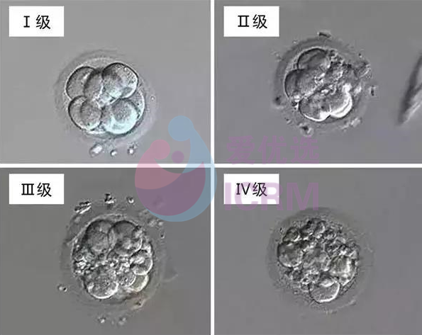 ICRM俄罗斯试管婴儿