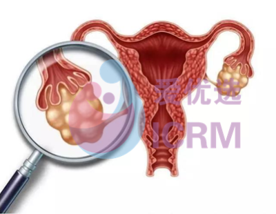 ICRM俄罗斯试管婴儿