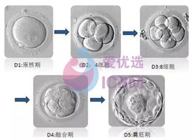 ICRM俄罗斯试管婴儿