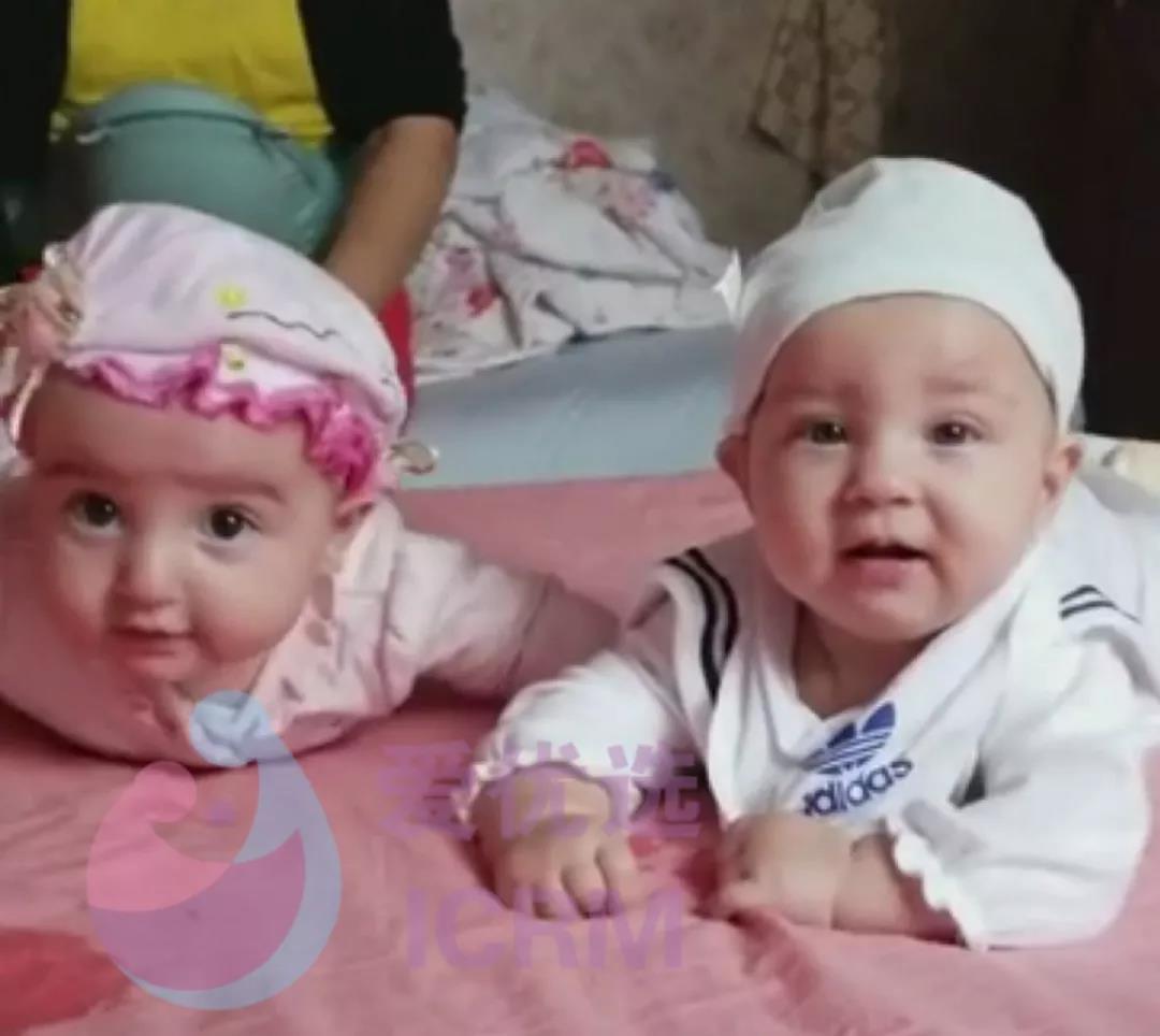 俄罗斯试管混血双胞胎宝宝近照