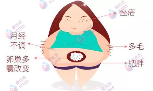 多囊卵巢综合征是如何引起的？可以做试管吗