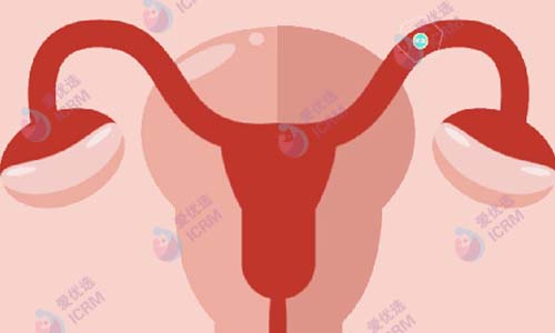 输卵管堵塞一定会导致不孕吗？