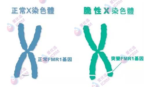 生娃要警惕这些“重男轻女”和“重女轻男”的遗传病