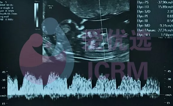 好孕预告（二）9月爱优选俄罗斯ICRM试管宝宝扎堆出生！