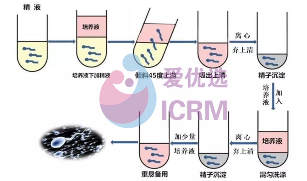 让“艾”孕育生命，优选家庭未来~