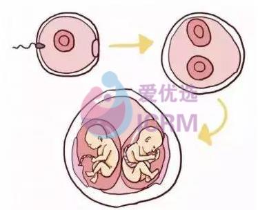为何现在双胞胎越来越多?这下知道原因了~